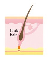 فازکاتاژن رشد مو